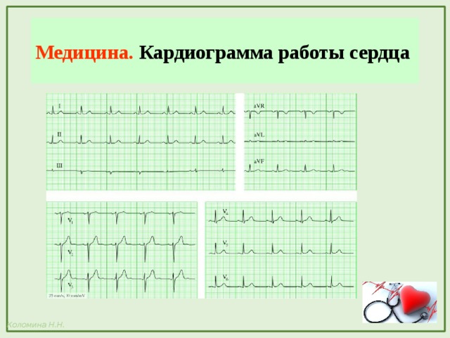 Медицина. Кардиограмма работы сердца 