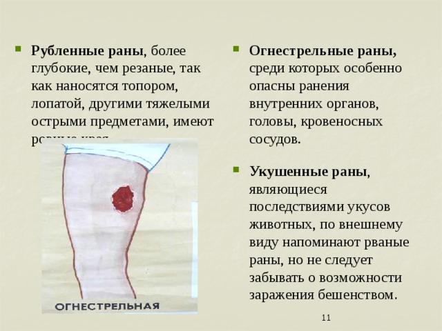 Огнестрельные раны, среди которых особенно опасны ранения внутренних органов, головы, кровеносных сосудов. Рубленные раны , более глубокие, чем резаные, так как наносятся топором, лопатой, другими тяжелыми острыми предметами, имеют ровные края. Укушенные раны , являющиеся последствиями укусов животных, по внешнему виду напоминают рваные раны, но не следует забывать о возможности заражения бешенством . 7 