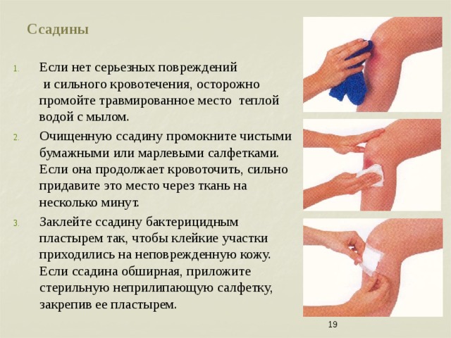 Ссадины Если нет серьезных повреждений и сильного кровотечения, осторожно промойте травмированное место теплой водой с мылом. Очищенную ссадину промокните чистыми бумажными или марлевыми салфетками. Если она продолжает кровоточить, сильно придавите это место через ткань на несколько минут. Заклейте ссадину бактерицидным пластырем так, чтобы клейкие участки приходились на неповрежденную кожу. Если ссадина обширная, приложите стерильную неприлипающую салфетку, закрепив ее пластырем. Если ссадина на руке или ноге, то ее можно погрузить ненадолго в теплую воду, чтобы смягчить перед тем Если ссадина на руке или ноге, то ее можно погрузить ненадолго в теплую воду, чтобы смягчить перед тем 1*. Если ссадина на руке или ноге, то ее можно погрузить ненадолго в теплую воду, чтобы смягчить перед тем, как удалять грязь.   