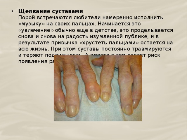 Щелкание суставами  Порой встречаются любители намеренно исполнить «музыку» на своих пальцах. Начинается это «увлечение» обычно еще в детстве, это проделывается снова и снова на радость изумленной публике, и в результате привычка «хрустеть пальцами» остается на всю жизнь. При этом суставы постоянно травмируются и теряют подвижность. А вместе с тем растет риск появления раннего артроза. 