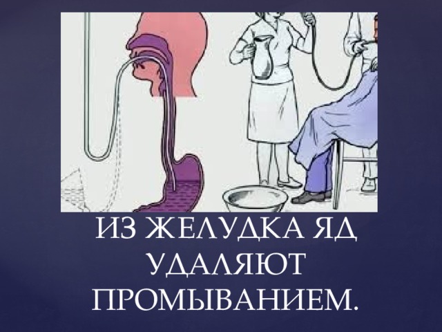 ИЗ ЖЕЛУДКА ЯД УДАЛЯЮТ ПРОМЫВАНИЕМ. 