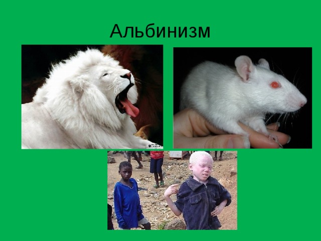 Альбинизм 