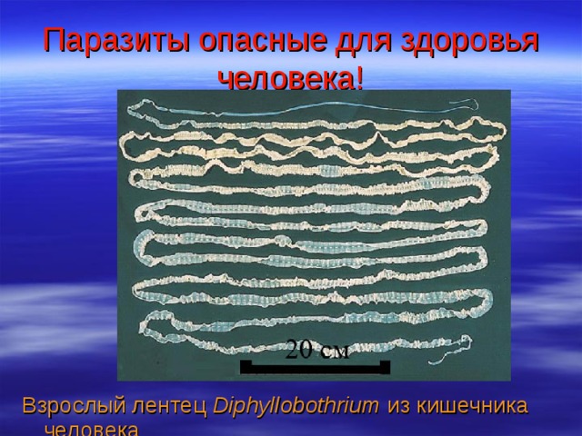Паразиты опасные для здоровья человека! Взрослый лентец Diphyllobothrium из кишечника человека 
