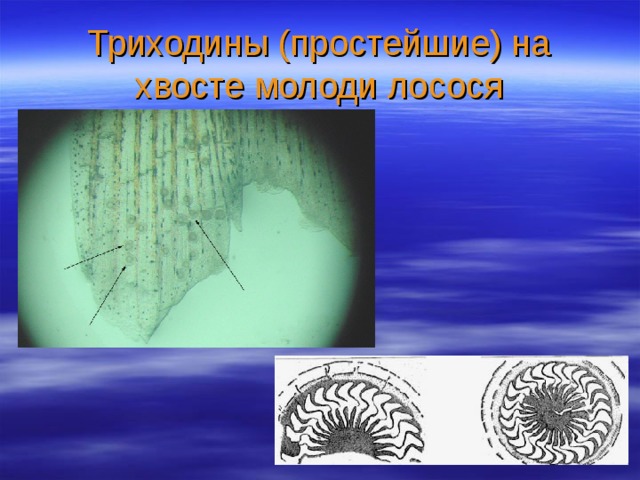 Триходины (простейшие) на хвосте молоди лосося 