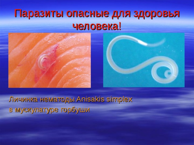 Паразиты опасные для здоровья человека! Личинка нематоды Anisakis simplex в мускулатуре горбуши 