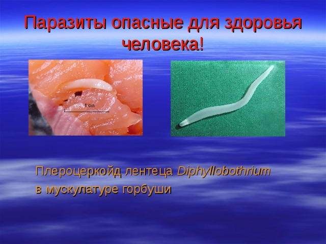Паразиты опасные для здоровья человека! Плероцеркойд лентеца Diphyllobothrium   в мускулатуре горбуши 
