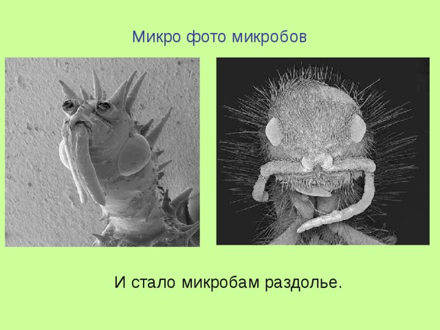 Микро фото микробов    И стало микробам раздолье. 