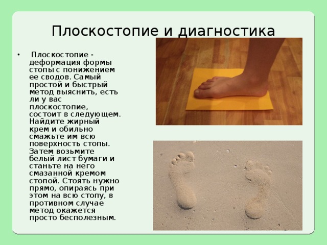 Плоскостопие и диагностика  Плоскостопие - деформация формы стопы с понижением ее сводов. Самый простой и быстрый метод выяснить, есть ли у вас плоскостопие, состоит в следующем. Найдите жирный крем и обильно смажьте им всю поверхность стопы. Затем возьмите белый лист бумаги и станьте на него смазанной кремом стопой. Стоять нужно прямо, опираясь при этом на всю стопу, в противном случае метод окажется просто бесполезным.  