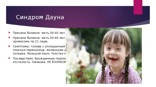 Синдром Дауна Причина болезни: мать 30-40 лет, наркотики. Причина болезни: мать 30-40 лет, наркотики. Утраивается хромосома по 21 паре. Симптомы: голова с уплощенным затылком, раскосые глаза, плоская переносица, маленькие уши, на ладони поперечная складка, большой язык, толстая короткая шея. Последствия: Врожденные пороки различных органов, умственная отсталость. Лечение: НЕ ВОЗМОЖНО! 