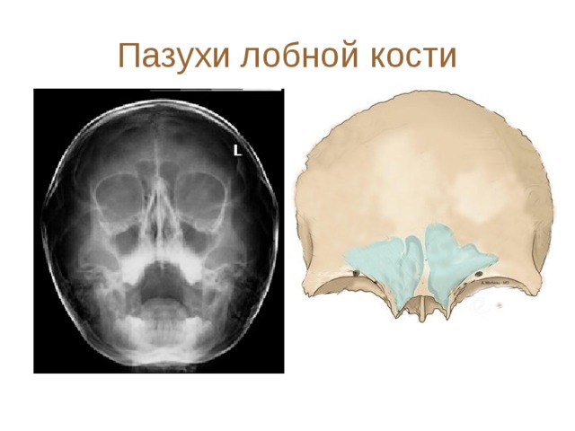 Пазухи лобной кости 