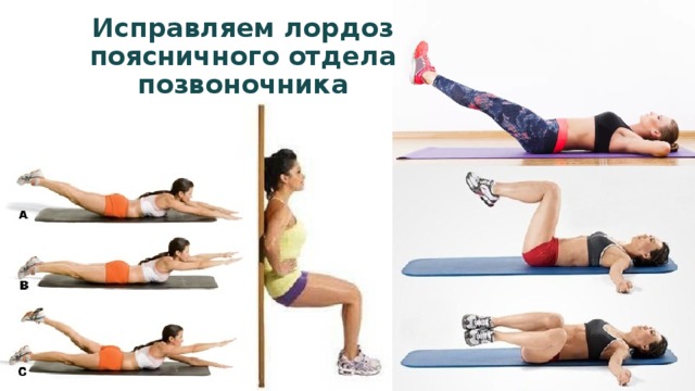 Исправляем лордоз поясничного отдела позвоночника 