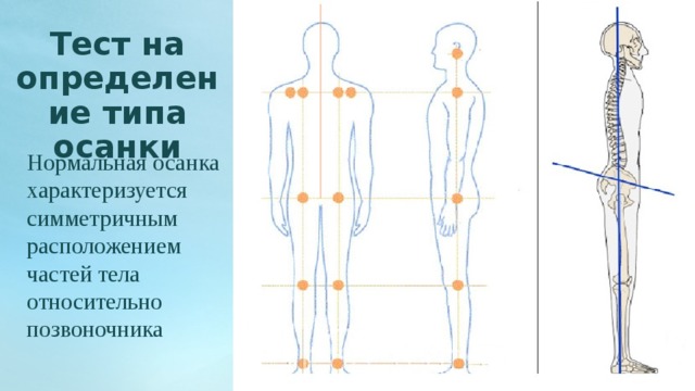 Тест на определение типа осанки Нормальная осанка характеризуется симметричным расположением частей тела относительно позвоночника 