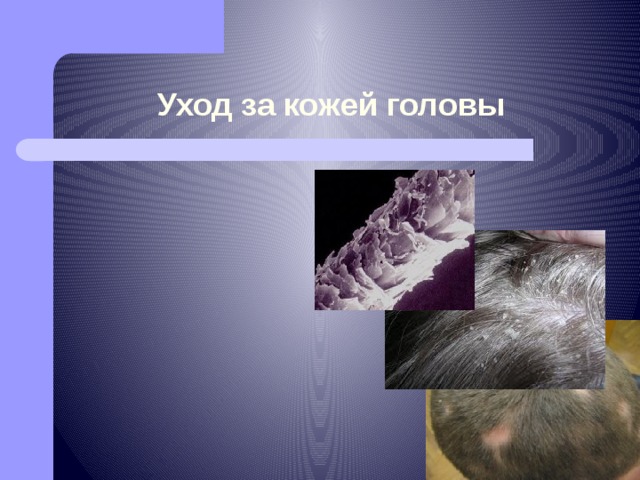 Уход за кожей головы 