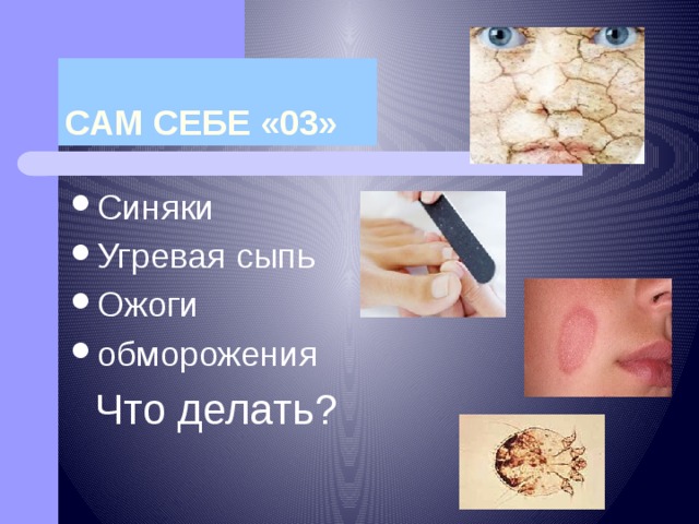 САМ СЕБЕ «03» Синяки Угревая сыпь Ожоги обморожения  Что делать? 