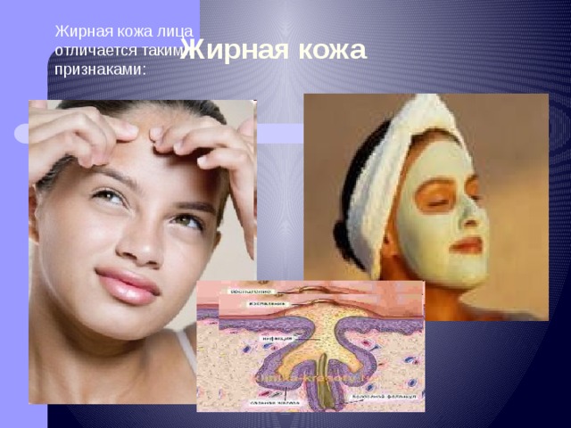 Жирная кожа Жирная кожа лица отличается такими признаками: -жирный блеск; -широкие поры; -угри; -кожа толстая; -серый цвет лица; -плохо держится макияж.  Жирная кожа лица считается проблемной, так как она склонная к появлению прыщей и угревой сыпи.  