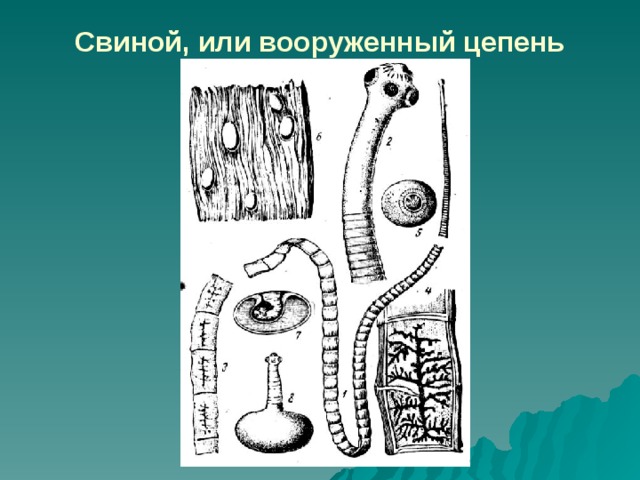Свиной, или вооруженный цепень 