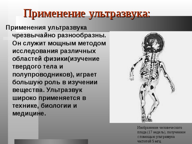 Применение ультразвука: Применения ультразвука чрезвычайно разнообразны. Он служит мощным методом исследования различных областей физики(изучение твердого тела и полупроводников), играет большую роль в изучении вещества. Ультразвук широко применяется в технике, биологии и медицине. Изображение человеческого плода (17 недель), полученное с помощью ультразвука частотой 5 мгц. 