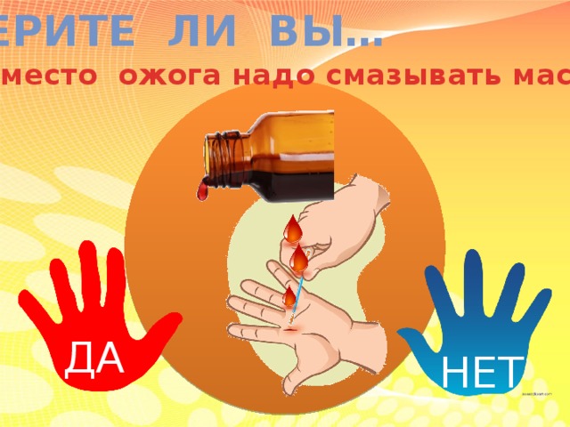 ВЕРИТЕ ЛИ ВЫ… что место ожога надо смазывать маслом? ДА НЕТ 