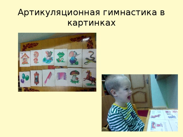 Артикуляционная гимнастика в картинках 