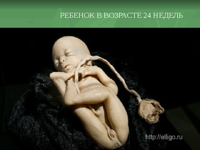 РЕБЕНОК В ВОЗРАСТЕ 24 НЕДЕЛЬ 