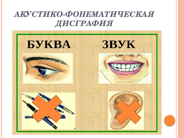 Акустико-фонематическая дисграфия 