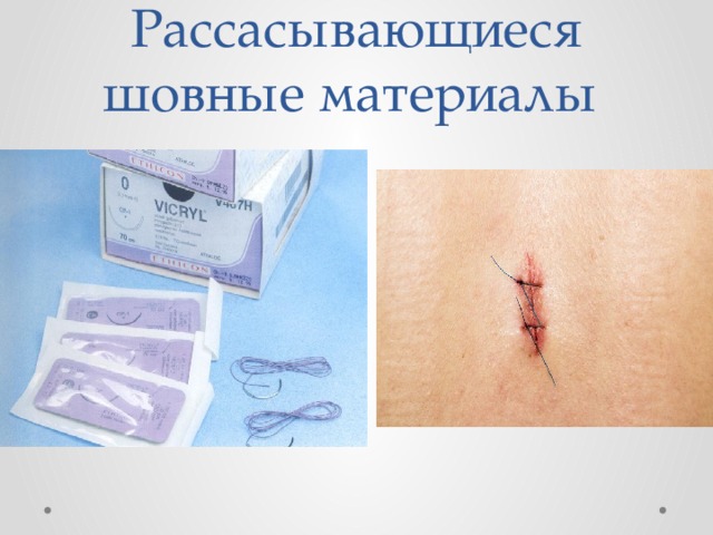 Рассасывающиеся шовные материалы 