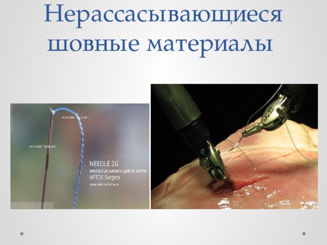 Нерассасывающиеся шовные материалы 