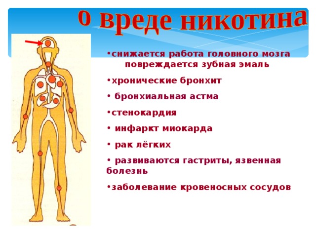 снижается работа головного мозга  повреждается зубная эмаль хронические бронхит  бронхиальная астма стенокардия  инфаркт миокарда  рак лёгких  развиваются гастриты, язвенная болезнь заболевание кровеносных сосудов 