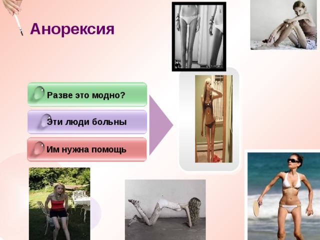 Анорексия  Разве это модно? Эти люди больны Им нужна помощь 