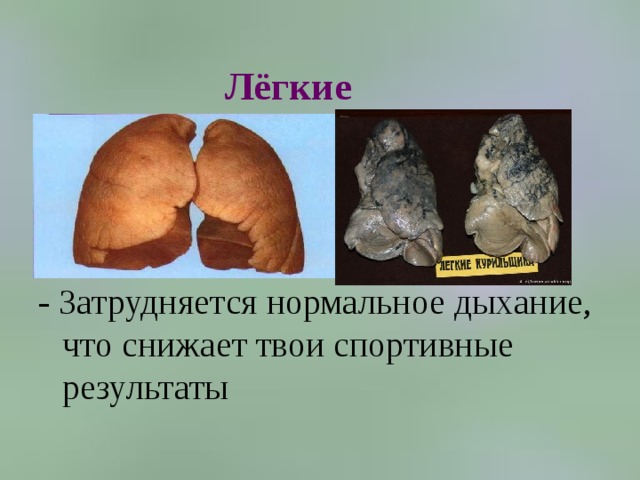 Лёгкие - Затрудняется нормальное дыхание, что снижает твои спортивные результаты 