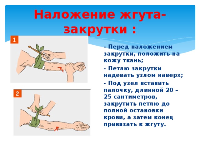 Наложение жгута-закрутки : - Перед наложением закрутки, положить на кожу ткань; - Петлю закрутки надевать узлом наверх; - Под узел вставить палочку, длинной 20 – 25 сантиметров, закрутить петлю до полной остановки крови, а затем конец привязать к жгуту. 