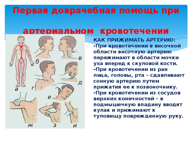 Первая доврачебная помощь при  артериальном кровотечении КАК ПРИЖИМАТЬ АРТЕРИЮ: -При кровотечении в височной области височную артерию пережимают в области мочки уха вперед к скуловой кости. -При кровотечении из ран лица, головы, рта – сдавливают сонную артерию путем прижатия ее к позвоночнику. -При кровотечении из сосудов верхних конечностей – в подмышечную впадину вводят кулак и прижимают к туловищу поврежденную руку. 