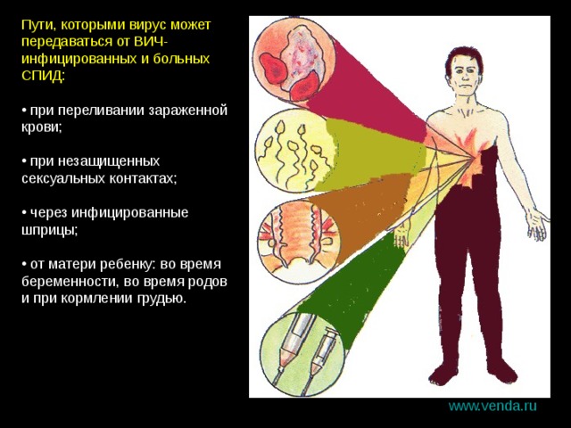 Пути, которыми вирус может передаваться от ВИЧ-инфицированных и больных СПИД:  при переливании зараженной крови;  при незащищенных сексуальных контактах;  через инфицированные шприцы;  от матери ребенку: во время беременности, во время родов и при кормлении грудью. www.venda.ru 