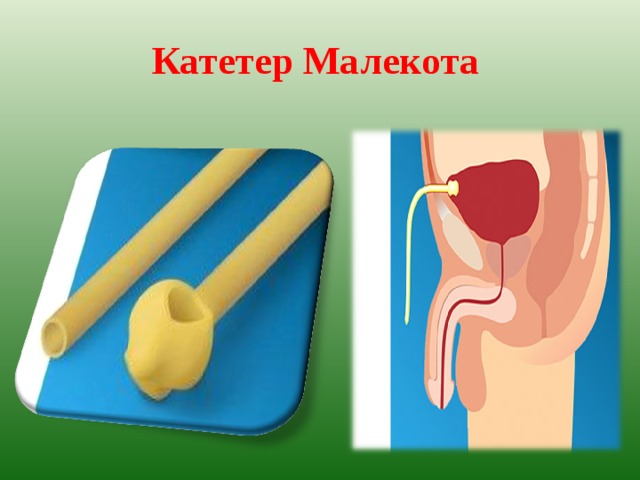 Катетер Малекота   