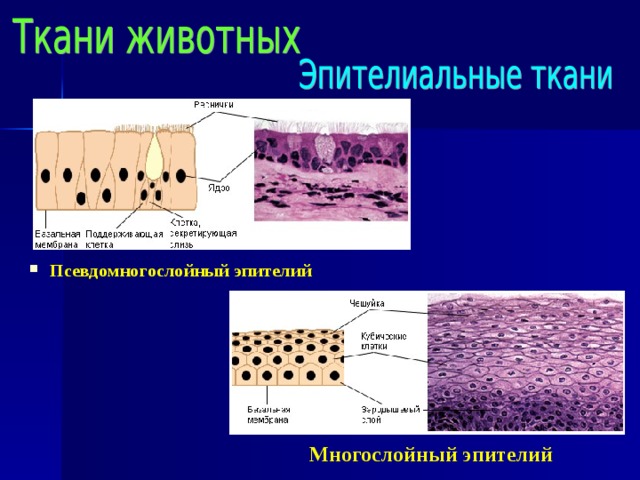 Псевдомногослойный эпителий Многослойный эпителий 