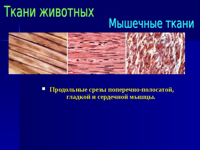 Продольные срезы поперечно-полосатой, гладкой и сердечной мышцы. 