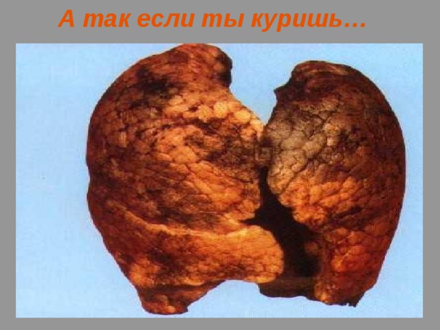А так если ты куришь… 