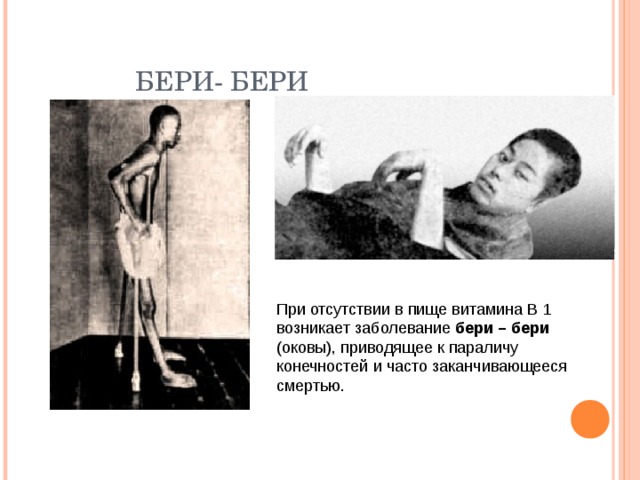  БЕРИ- БЕРИ При отсутствии в пище витамина В 1 возникает заболевание бери – бери (оковы), приводящее к параличу конечностей и часто заканчивающееся смертью. 