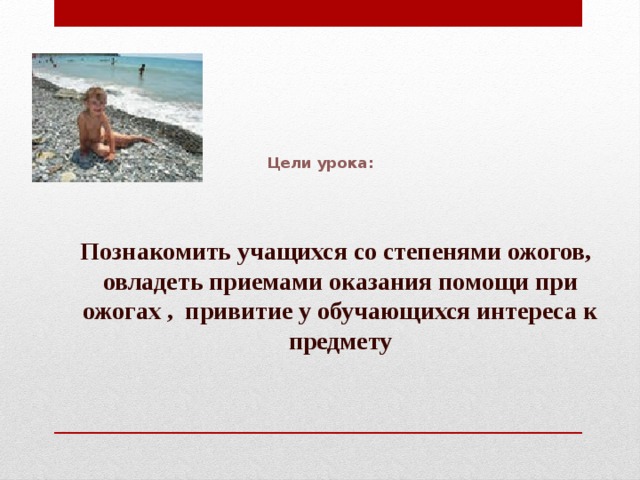  Цели урока:    Познакомить учащихся со степенями ожогов, овладеть приемами оказания помощи при ожогах , привитие у обучающихся интереса к предмету 