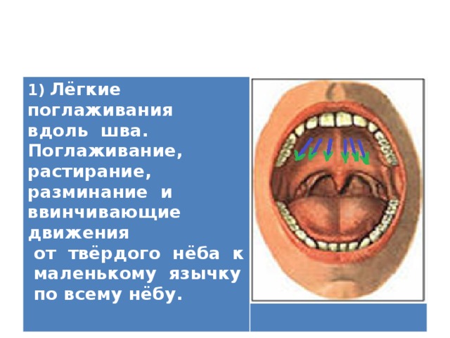 1) Лёгкие поглаживания вдоль шва. Поглаживание, растирание, разминание и ввинчивающие движения  от твёрдого нёба к маленькому язычку по всему нёбу.   