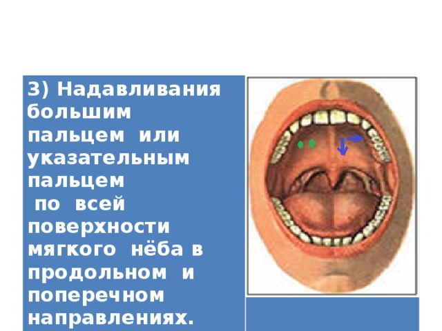 3) Надавливания большим пальцем или указательным пальцем  по всей поверхности мягкого нёба в продольном и поперечном направлениях.   