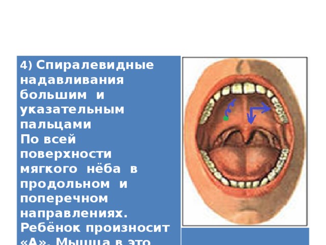 4) Спиралевидные надавливания большим и указательным пальцами По всей поверхности мягкого нёба в продольном и поперечном направлениях. Ребёнок произносит «А». Мышца в это время сокращается.    