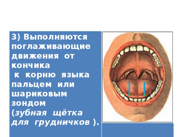 3) Выполняются поглаживающие движения от кончика  к корню языка пальцем или шариковым зондом ( зубная щётка для грудничков ).   