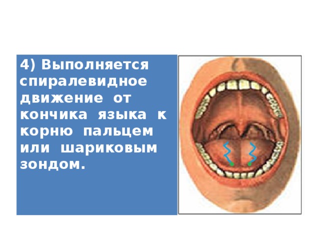 4) Выполняется спиралевидное движение от кончика языка к корню пальцем или шариковым зондом.   