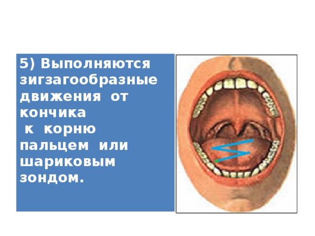 5) Выполняются зигзагообразные движения от кончика  к корню пальцем или шариковым зондом.  