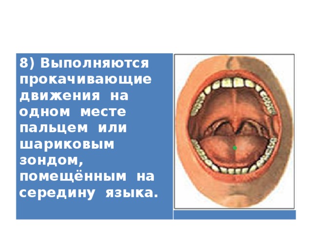 8) Выполняются прокачивающие движения на одном месте пальцем или шариковым зондом, помещённым на середину языка.   