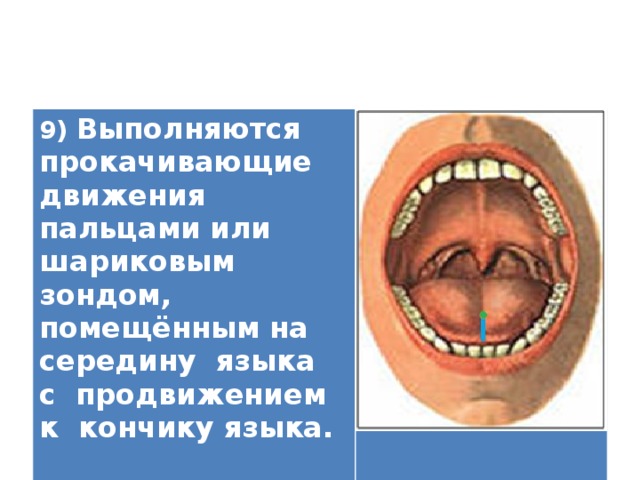 9) Выполняются прокачивающие движения пальцами или шариковым зондом, помещённым на середину языка с продвижением к кончику языка.   
