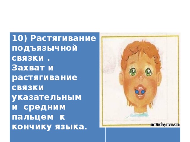 10) Растягивание подъязычной связки . Захват и растягивание связки указательным и средним пальцем к кончику языка.   