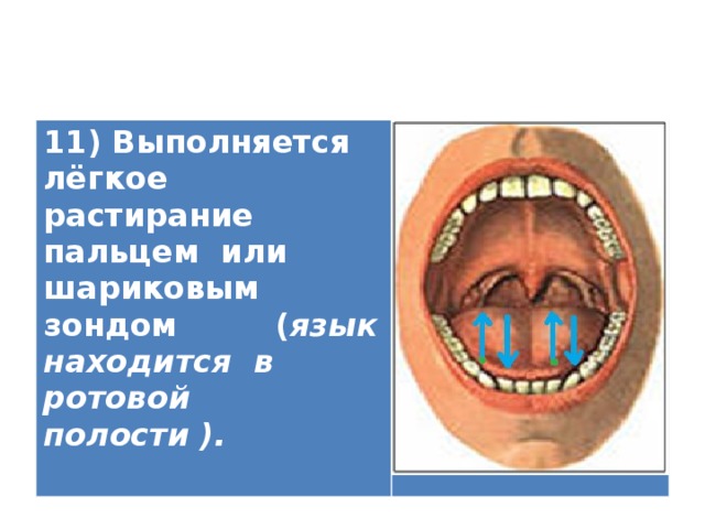 11) Выполняется лёгкое растирание пальцем или шариковым зондом ( язык находится в ротовой полости ).   