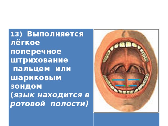 13) Выполняется лёгкое поперечное штрихование  пальцем или шариковым зондом ( язык находится в ротовой полости)    
